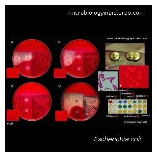 ecoli